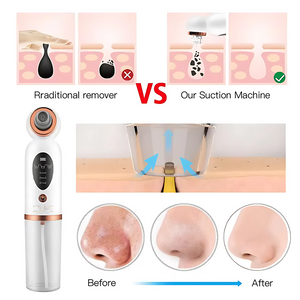 Facial Cleansing Device Micro Vibration Pore Shrinking Face Cleaner, Waterproof Rechargeable Skin Scrubber, Blackhead Remover Gentle Facial Massager for Deep Pore Cleaning | Designed in UAE