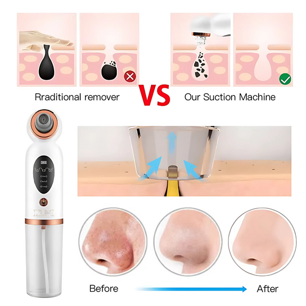 Facial Cleansing Device Micro Vibration Pore Shrinking Face Cleaner, Waterproof Rechargeable Skin Scrubber, Blackhead Remover Gentle Facial Massager for Deep Pore Cleaning | Designed in UAE