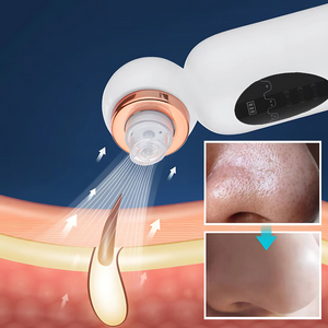 Facial Cleansing Device Micro Vibration Pore Shrinking Face Cleaner, Waterproof Rechargeable Skin Scrubber, Blackhead Remover Gentle Facial Massager for Deep Pore Cleaning | Designed in UAE
