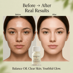 Pury Age Sebum - Balancing Serum 30ml - S94BEAUTYHUB